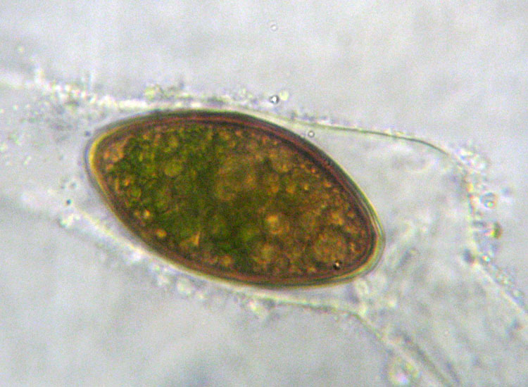 Alghe 3: Spirogyra sp